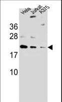 ARL6IP6 Antibody (aa19-47)