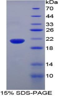 Rat FAT10 / UBD Protein (Recombinant His-T7)