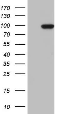 TLK2 Antibody (aa1-296, clone OTI2F9, Carrier-free)