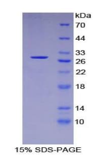 Human FOXO1 / FKHR Protein (Recombinant)