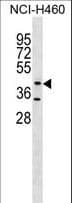 GLT8D1 Antibody (aa338-366)