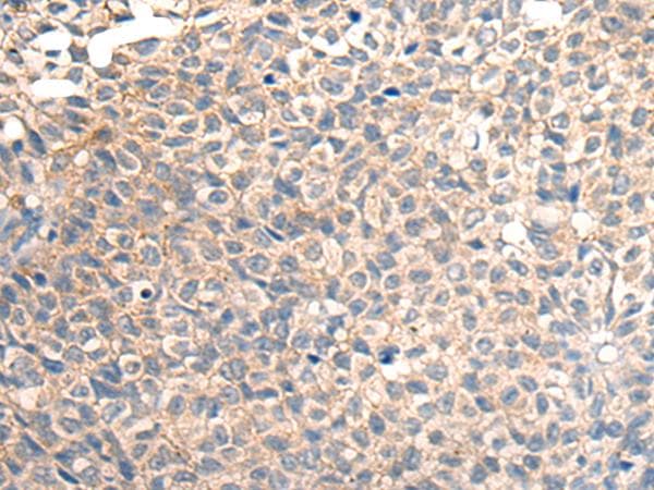 TRAIL-R4 / DCR2 Antibody