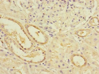 LPIN1 / Lipin 1 Antibody