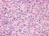 IHC-plus™ Polyclonal Rabbit anti-Human GPR171 Antibody (Extracellular Domain, IHC)