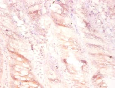 PLAU / Urokinase / uPA Antibody