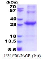 Human CD33 Protein (Recombinant His, N-Terminal)