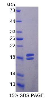 Rat MMP13 Protein (Recombinant His, N-terminus)