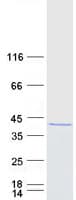 Human PRMT6 Protein (Recombinant Myc-DDK (Flag))