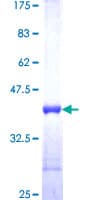 Human S100A3 / S100E Protein (Recombinant GST, N-terminus)