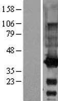 GALE / UDP-Glucose 4-Epimerase Protein (Over-Expression Lysate Myc-DDK (Flag))