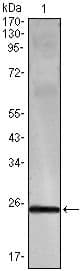 IFN Gamma / Interferon Gamma Antibody (clone 3F1E3)