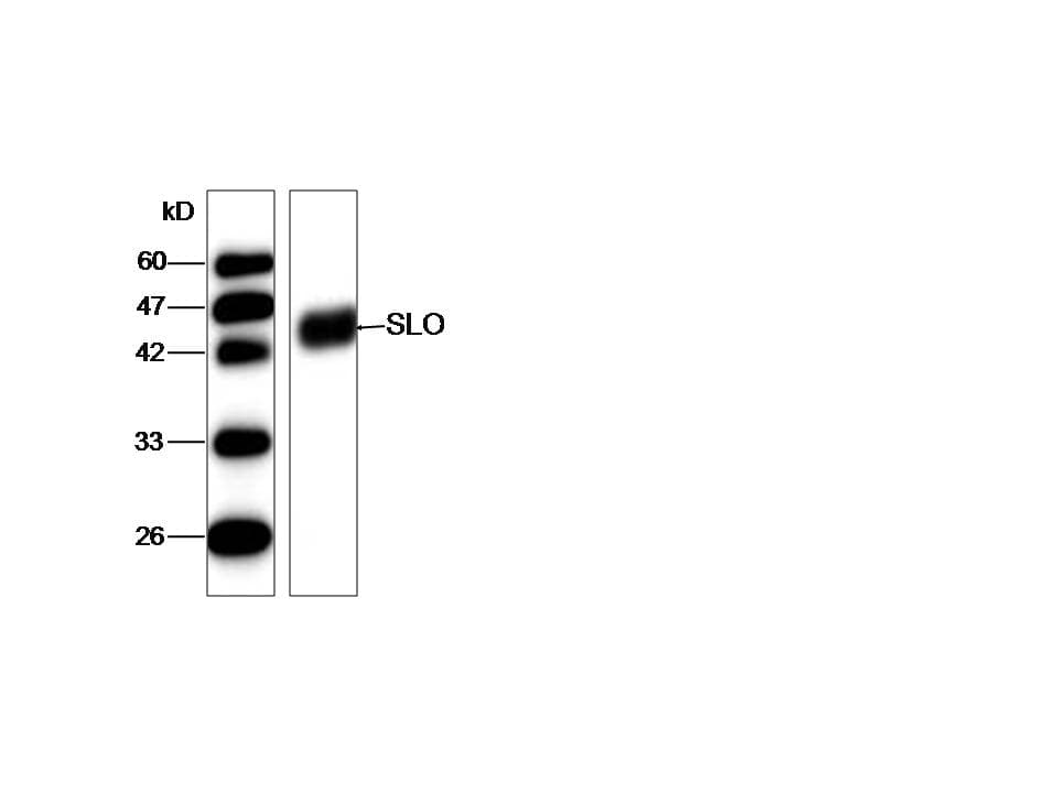 Streptolysin O Antibody (aa78-206)