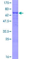 Human ESAM Protein (Recombinant GST)