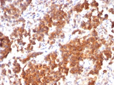 TNFSF15 / TL1A / VEGI Antibody (clone rVEGI/1283, Azide-free, Carrier-free)
