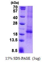 Human CGB / hCG Beta Protein (Recombinant His)