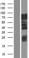 CALD1 / Caldesmon Protein (Over-Expression Lysate Myc-DDK (Flag))