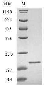 Human TREM2 / TREM-2 Protein (Recombinant 6His, N-terminus)