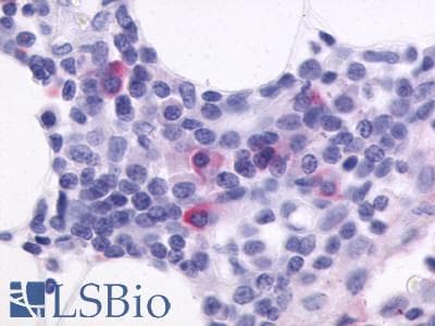 IHC-plus™ Polyclonal Rabbit anti-Human CXCR5 Antibody (C-Terminus, IHC)
