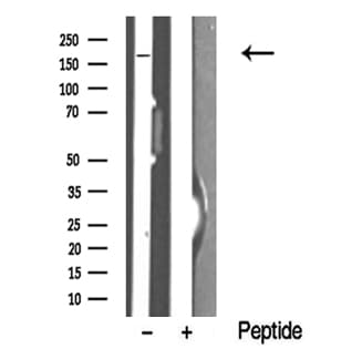 Polyclonal Rabbit anti-Human TOPBP1 Antibody (WB)