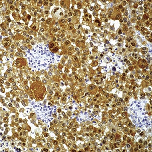 S100B / S100 Beta Antibody (clone 4C4.9)