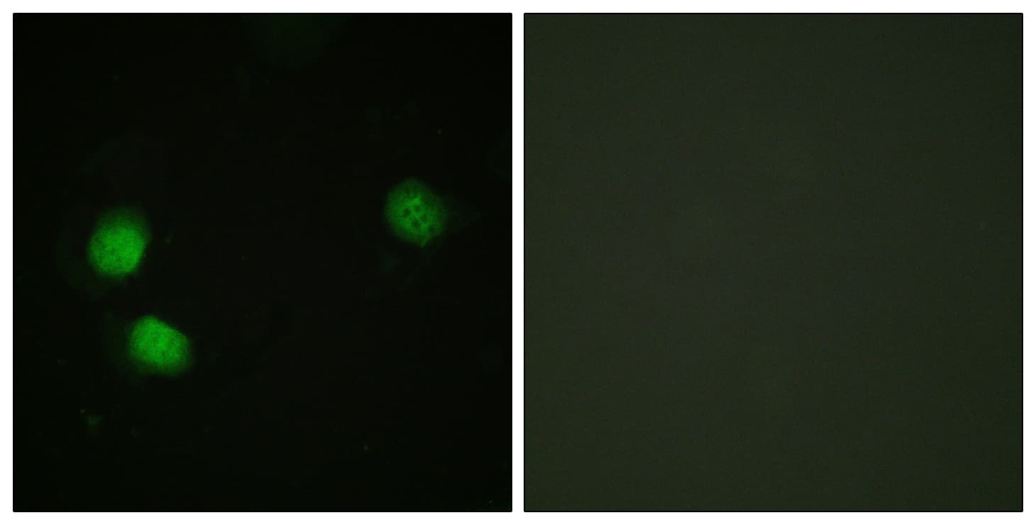 BLM Antibody (phospho-Thr99)