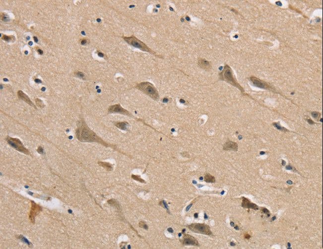 DLG2 / PSD93 Antibody