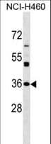 Polyclonal Rabbit anti-Human NAT6 / FUS2 Antibody (aa150-179, WB)