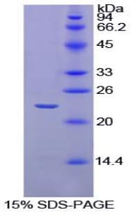 Horse IL-1B / IL-1 Beta Protein (Recombinant His)