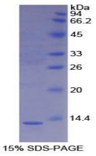 Mouse S100A4 / FSP1 Protein (Recombinant His)
