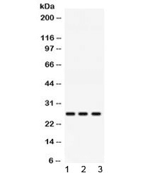 AK2 / Adenylate Kinase 2 Antibody