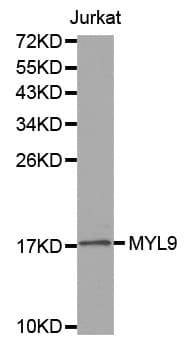 Polyclonal Rabbit anti-Human MLC2 / MYL9 Antibody (IHC, WB)