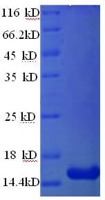 Human GLP1R / GLP-1 Receptor Protein (Recombinant His)