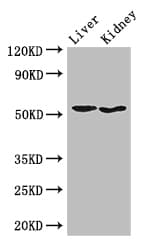 Polyclonal Rabbit anti-Human SNX17 Antibody (IHC, IF, WB)