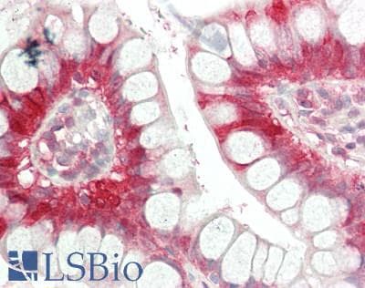 IHC-plus™ Polyclonal Rabbit anti-Human I-FABP / FABP2 Antibody (IHC, IF, WB)
