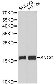 Polyclonal Rabbit anti-Human SNCG / Gamma-Synuclein Antibody (WB)
