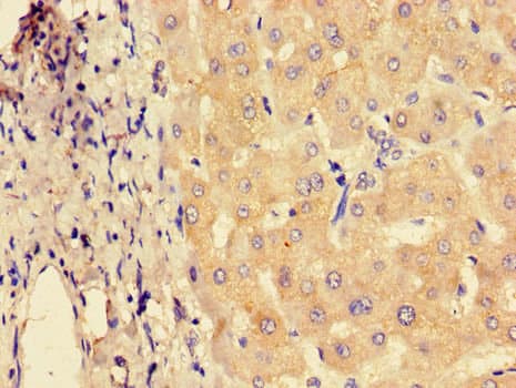 SYVN1 / HRD1 Antibody