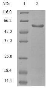 Mouse Fibulin-3 / EFEMP1 Protein (Recombinant 6His, N-terminus)