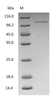 TF / Transferrin Protein (Native)