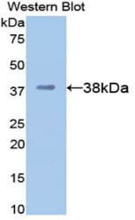 APOH / Apolipoprotein H Antibody (aa21-345)