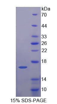 Human EEA1 Protein (Recombinant His-T7)