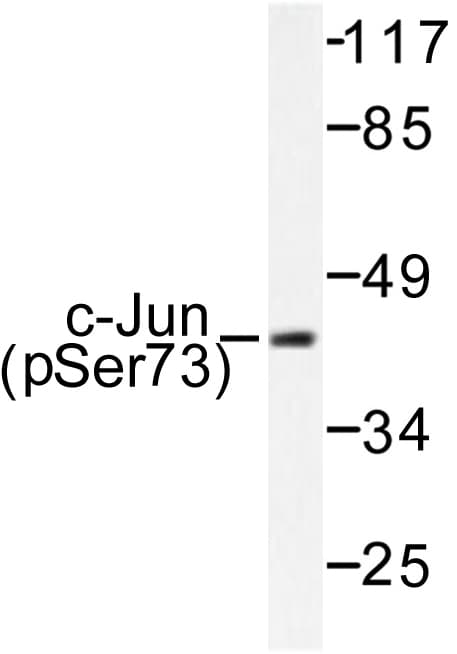JUN / c-Jun Antibody (phospho-Ser73)