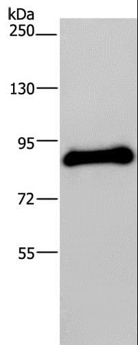 Polyclonal Rabbit anti-Human POMT1 Antibody (IHC, WB)