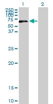 UPF3A / UPF3 Antibody (clone 2E2)