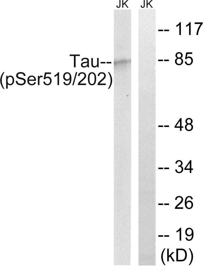 MAPT / Tau Antibody (phospho-Ser519/202)