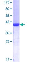 Human DVL1 / DVL / Dishevelled Protein (Recombinant GST, N-terminus)