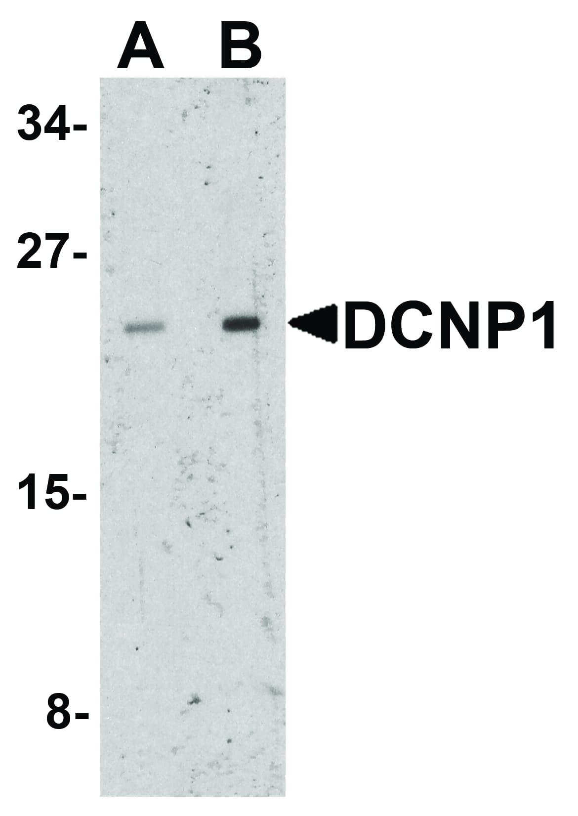 DCANP1 Antibody