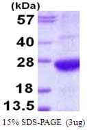 Human AMBP Protein (Recombinant His)