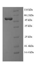 Human TDP-43 / TARDBP Protein (Recombinant GST, N-terminus)