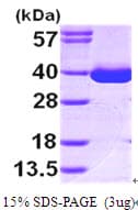 Human MDH1 Protein (Recombinant His)