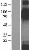 ITGB6 / Integrin Beta 6 Protein (Over-Expression Lysate Myc-DDK (Flag))